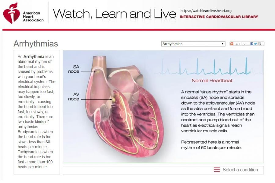 Image and Link to https://watchlearnlive.heart.org